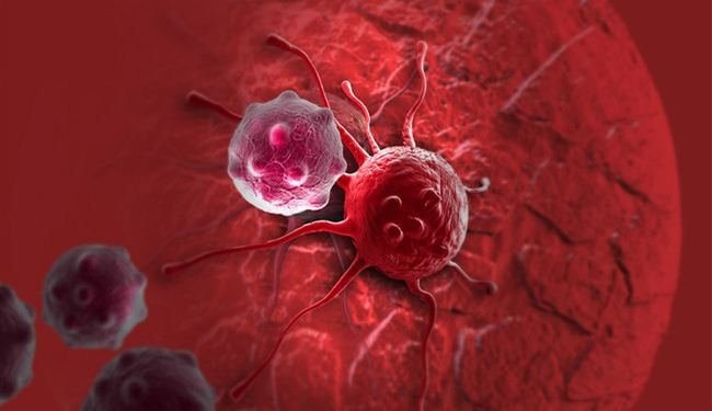 أنواع الأورام الخبيثة