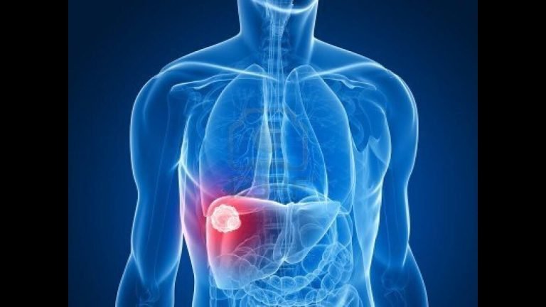 أمراض الكبد وأعراضها