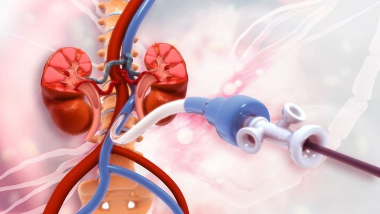 ما هي القسطرة القلبية