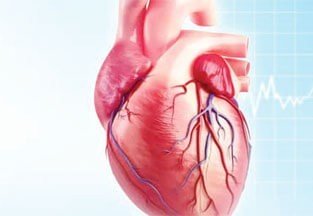 شكل القسطرة القلبية 