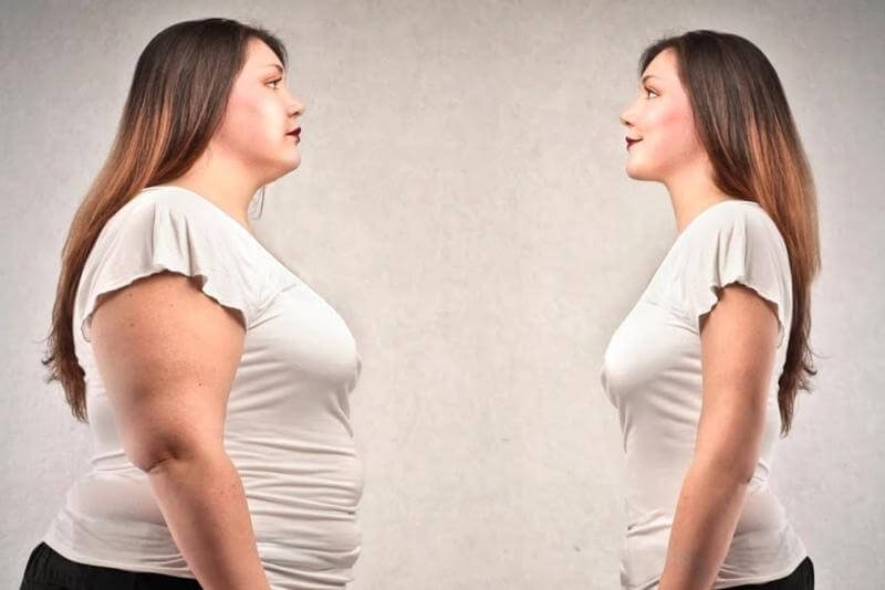 الأشعة التداخلية لعلاج السمنة