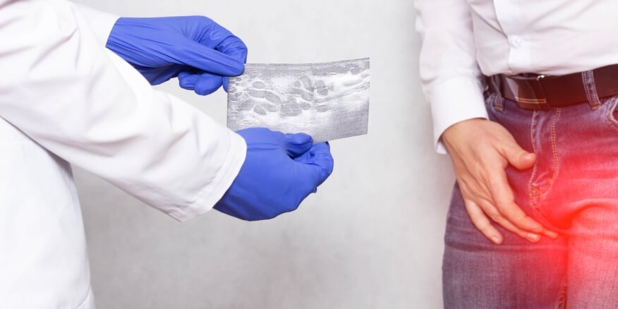 اسعار الاشعة التداخلية لدوالي الخصية