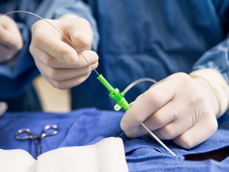 أسعار القسطرة القلبية التشخيصية