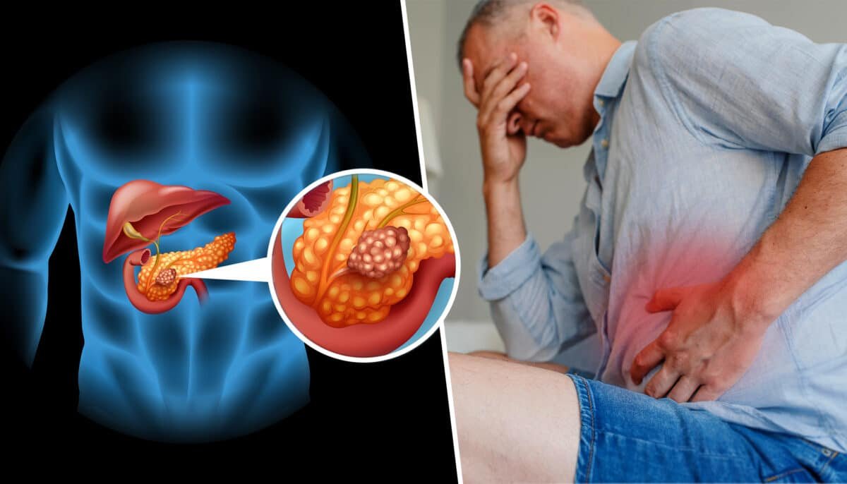 هل يشفي مريض سرطان البنكرياس