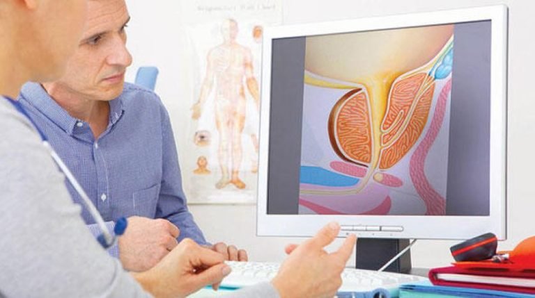 أعراض تضخم البروستاتا