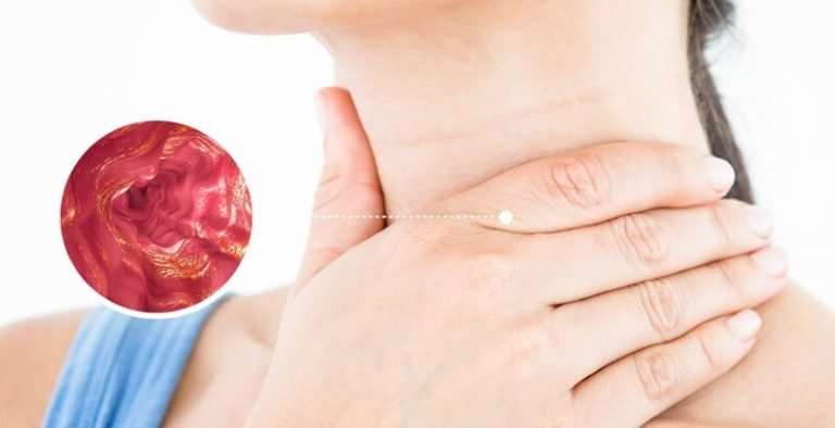 هل دوالي المريء خطيرة