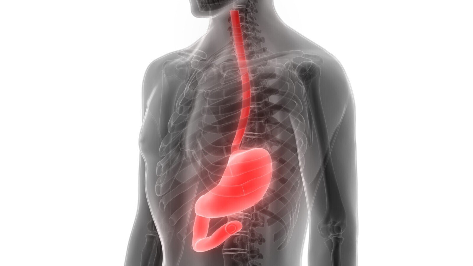 دوالي المعدة