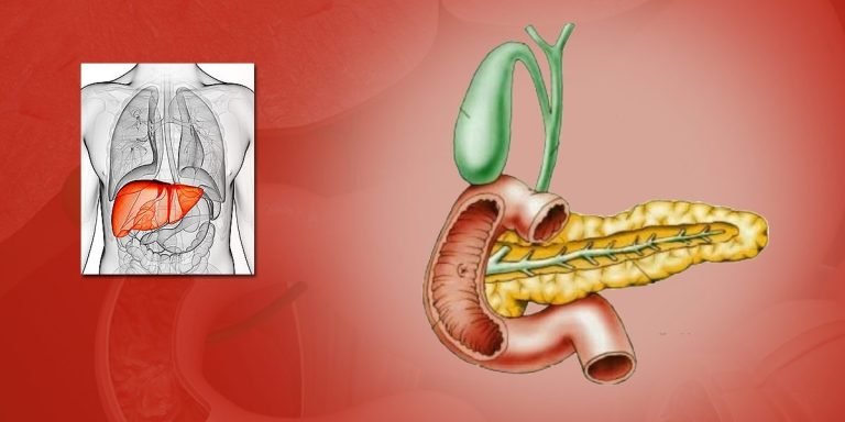 انسداد القناة المرارية