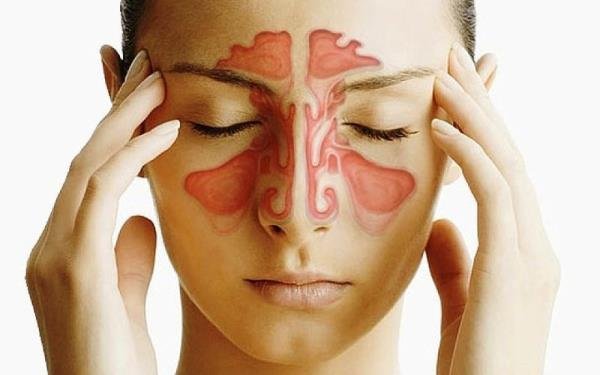 علاج الجيوب الانفية