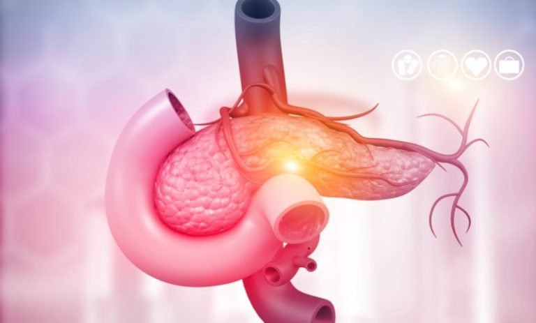 أعراض أورام البنكرياس