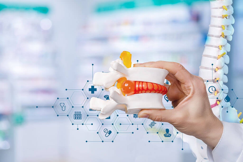 تكلفة عملية الانزلاق الغضروفي