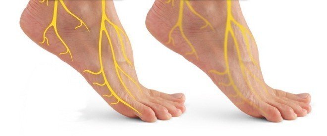 التهاب الاعصاب الطرفية