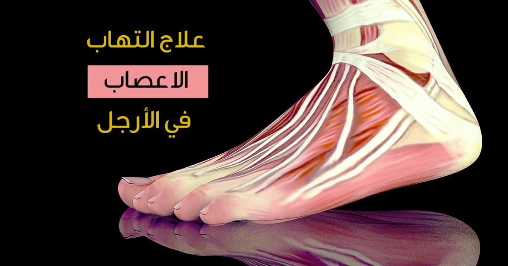  علاج التهاب الأعصاب الطرفية