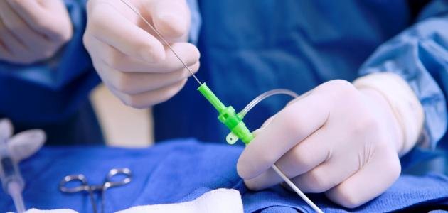 قسطرة القلب