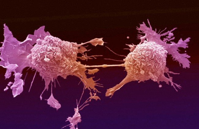 أفضل مراكز علاج الأورام في مصر