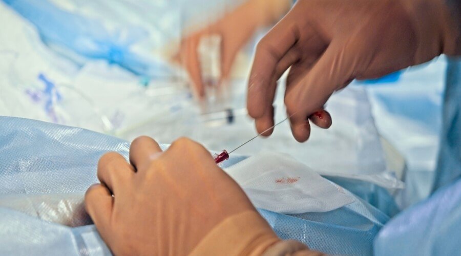 بديل القسطرة القلبية