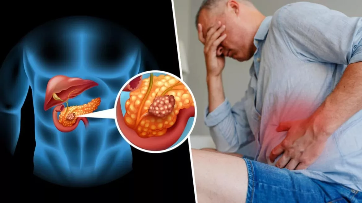 اورام البنكرياس