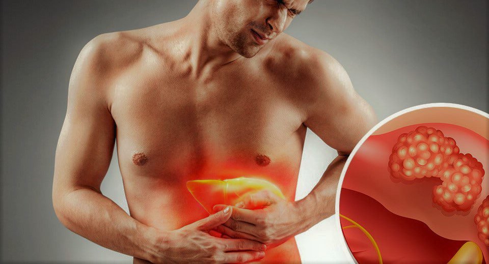 ما هي طرق علاج اورام الكبد