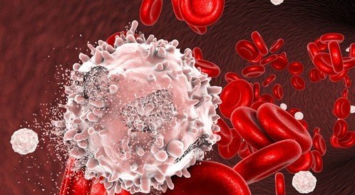 طرق علاج اللوكيميا