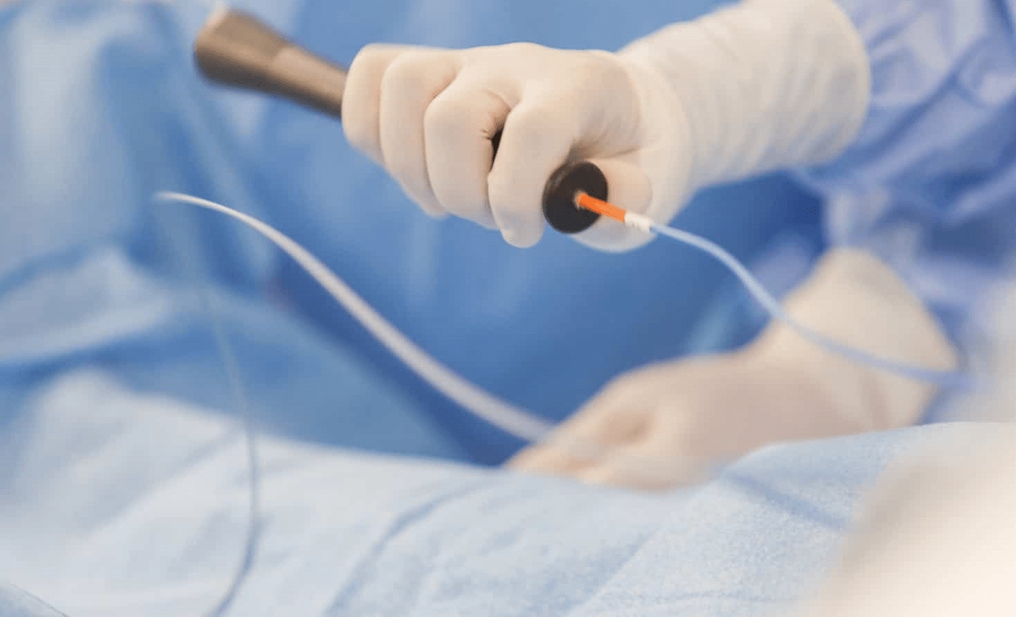 مدة عملية قسطرة القلب