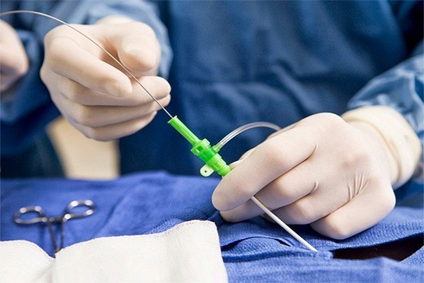 اعراض ما بعد عملية قسطرة الرحم